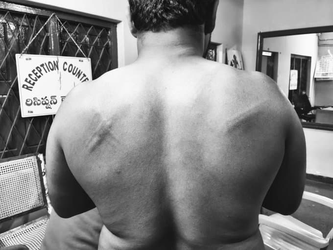 Tension in Balakrishna’s Constituency After Attack on Journalist in Chilamathur