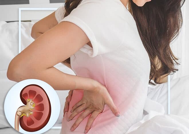 Are your daily habits causing kidney stones?